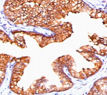 PMEPA1 Antibody / TMEPAI