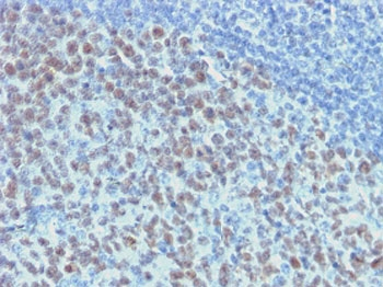 Recombinant Bcl6 Antibody