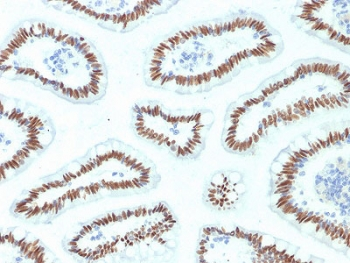 HNF1A Antibody