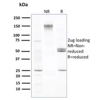 Prealbumin Antibody / Transthyretin / TTR