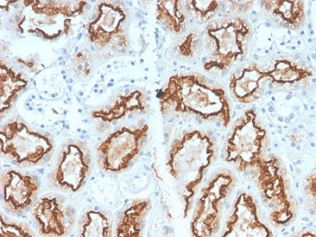 Recombinant Carbonic Anhydrase 9 Antibody