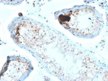 Calbindin 2 Antibody / CALB2 / Calretinin