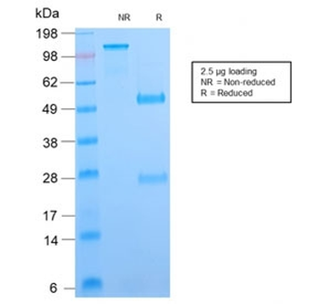 VTCN1 Antibody / B7H4