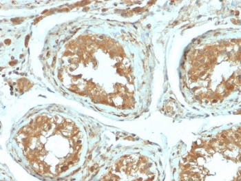 Recombinant B7-H4 Antibody / VTCN1
