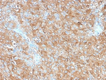 Recombinant CD63 Antibody / LAMP-3