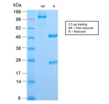 Recombinant CD6 Antibody