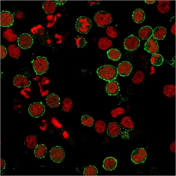 Recombinant CD6 Antibody