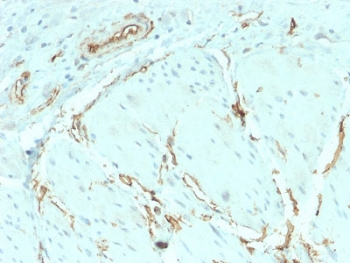 Recombinant CD34 Antibody