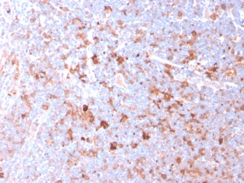 CD40L Antibody / TRAP / CD154