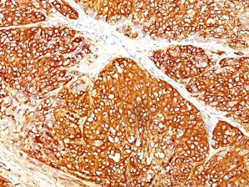 Melanoma Marker Antibody Cocktail
