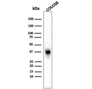 Melanoma Marker Antibody Cocktail