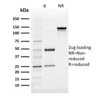 Aldose reductase Antibody / AKR1B1