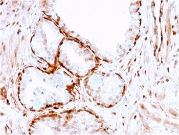 Aldose reductase Antibody / AKR1B1