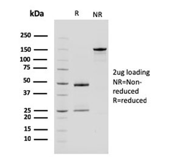 Carboxypeptidase A1 Antibody / CPA1