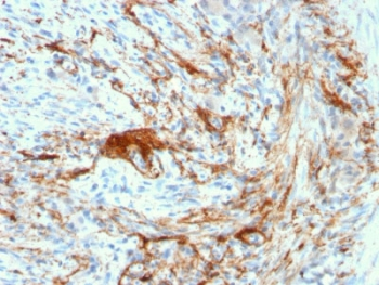 Recombinant Elastin Antibody