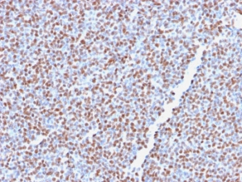 Recombinant ALK Antibody / Anaplastic Lymphoma Kinase