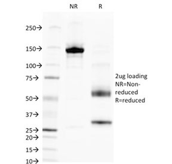 ALPL Antibody / Alkaline Phosphatase (tissue-nonspecific)