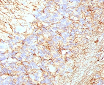Neurofilament Antibody (-Heavy) / NF-H / NEFH
