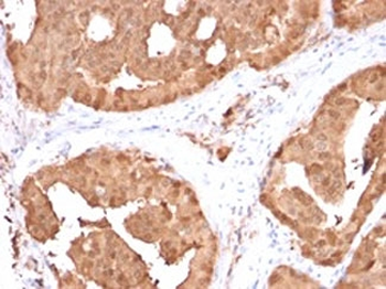 GLO1 Antibody / Glyoxalase I
