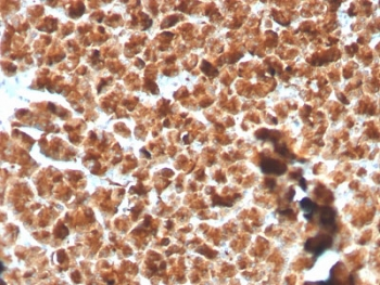 Recombinant GP2 Antibody / Glycoprotein 2 / ZAP75
