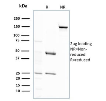 GSTM2 Antibody / Glutathione S-Transferase mu 2
