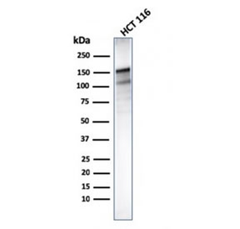 MSH6 Antibody