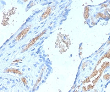 Recombinant SPTA1 Antibody / Spectrin alpha 1