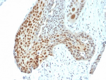Phospho-JUN Antibody (pT91/93)