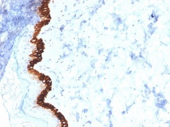 KRT15 Antibody / Cytokeratin 15