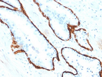 KRT15 Antibody / Cytokeratin 15