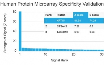 KRT15 Antibody / Cytokeratin 15