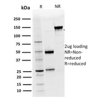 KRT15 Antibody / Cytokeratin 15