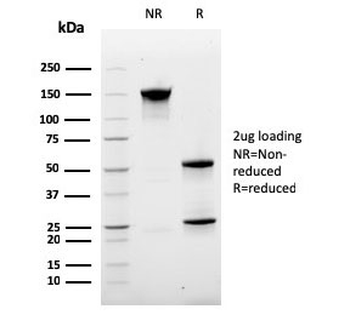Ki67 Antibody