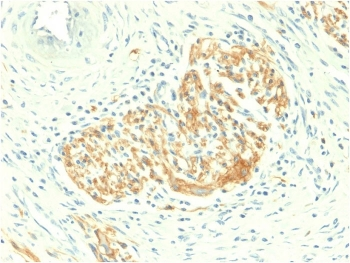 Recombinant CD56 Antibody