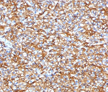 SPTBN2 Antibody / Spectrin beta III