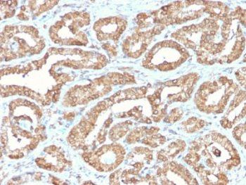 Recombinant ODC1 Antibody