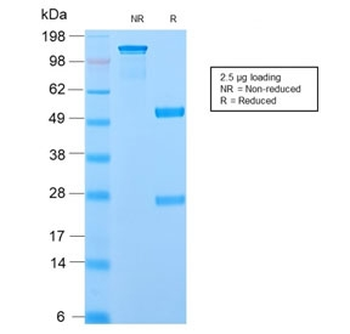 Recombinant ODC1 Antibody