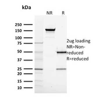 POLR2A Antibody / RNA polymerase II subunit RPB1