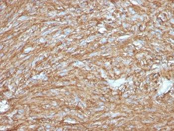 Recombinant TMEM16A Antibody / DOG1 / ANO1