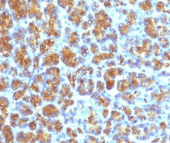 Recombinant CELA3B Antibody / Elastase 3B