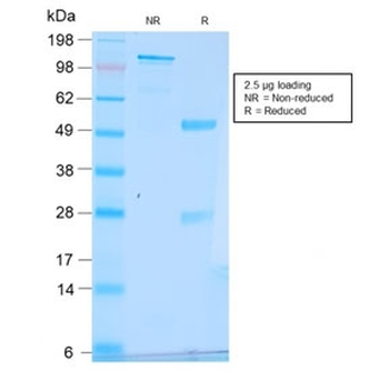 Recombinant pS2 Antibody / TFF1