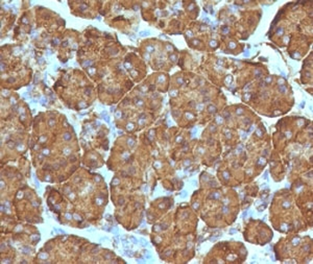 Recombinant TOP1MT Antibody