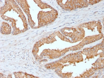 Ezrin Antibody / EZR