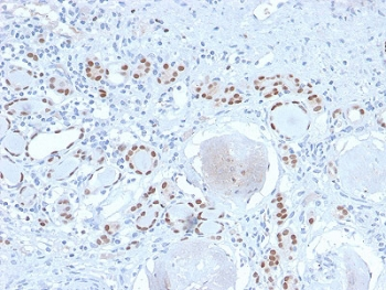 Recombinant PAX8 Antibody