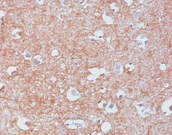 Recombinant NF-L Antibody / Neurofilament Light