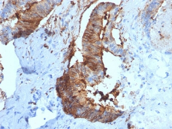 Cathepsin D Antibody / CTSD