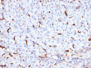 Cathepsin K Antibody / CTSK