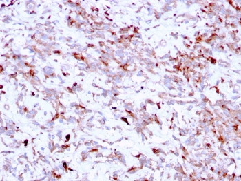 Cathepsin K Antibody / CTSK