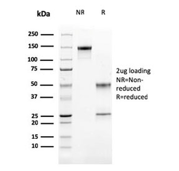 Cathepsin K Antibody / CTSK