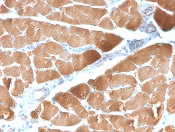 Recombinant Desmin Antibody